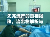 先兆流產(chǎn)的真相揭秘，流出物解析與應(yīng)對(duì)策略