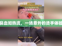 鼻血如熱流，一場(chǎng)意外的燙手體驗(yàn)