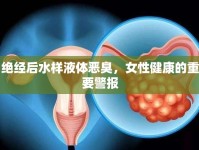 絕經(jīng)后水樣液體惡臭，女性健康的重要警報