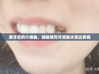 拔牙后的小插曲，揭秘拔完牙洞酸水流出真相