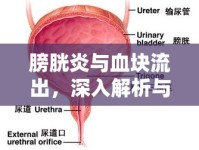 膀胱炎與血塊流出，深入解析與應(yīng)對策略