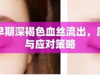 孕早期深褐色血絲流出，原因與應(yīng)對(duì)策略
