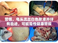警惕，龜頭流出白色膿液并伴有血跡，可能是性健康警報(bào)