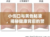 小傷口與黃色粘液，揭秘健康背后的警示信號(hào)