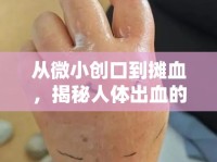 從微小創(chuàng)口到攤血，揭秘人體出血的驚人時間之旅