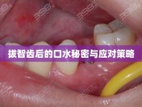 拔智齒后的口水秘密與應(yīng)對策略