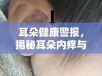 耳朵健康警報(bào)，揭秘耳朵內(nèi)癢與白色膿液流出的真相