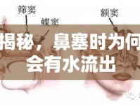 揭秘，鼻塞時為何會有水流出
