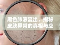 黑色膿液流出，揭秘皮膚異常的真相與應(yīng)對策略