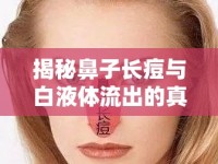 揭秘鼻子長痘與白液體流出的真相