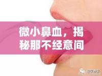 微小鼻血，揭秘那不經(jīng)意間流出的紅色秘密