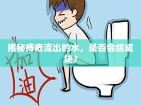 揭秘痔瘡流出的水，是否會(huì)結(jié)成塊？