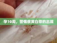孕10周，警惕很黃白帶的出現(xiàn)