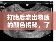 打胎后流出物質(zhì)的顏色揭秘，了解真相，理性面對