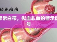 異常白帶，似血非血的警示信號