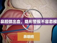 鼻腔微出血，隱形警報(bào)不容忽視
