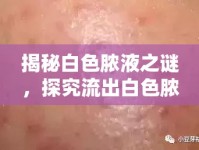 揭秘白色膿液之謎，探究流出白色膿液的包背后的真相