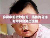 鼻涕中的微妙信號，揭秘流鼻涕時為何會流出血絲