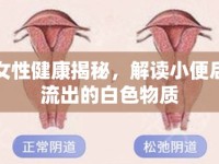女性健康揭秘，解讀小便后流出的白色物質(zhì)