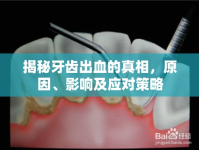揭秘牙齒出血的真相，原因、影響及應(yīng)對策略