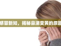 感冒新知，揭秘鼻涕變黃的原因