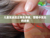 兒童耳朵流出黃色液體，警惕中耳炎的跡象