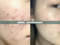 揭秘膿包，血水背后的皮膚秘密