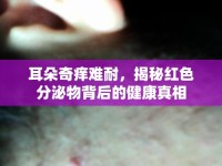 耳朵奇癢難耐，揭秘紅色分泌物背后的健康真相