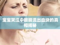 寶寶哭泣中眼睛流出血塊的真相揭秘