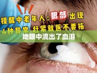 她眼中流出了血淚