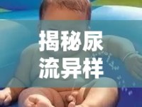 揭秘尿流異樣，日常不適背后的健康真相與警報(bào)