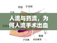 人流與藥流，為何人流手術(shù)出血量相對較少？