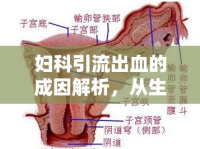 婦科引流出血的成因解析，從生理機制到病理變化的全面探討