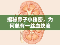 揭秘鼻子小秘密，為何總有一絲血塊流出？
