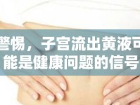警惕，子宮流出黃液可能是健康問題的信號