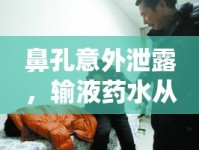 鼻孔意外泄露，輸液藥水從鼻子流出引發(fā)的醫(yī)療事故