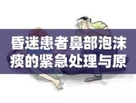 昏迷患者鼻部泡沫痰的緊急處理與原因分析