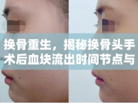 換骨重生，揭秘?fù)Q骨頭手術(shù)后血塊流出時(shí)間節(jié)點(diǎn)與護(hù)理要點(diǎn)