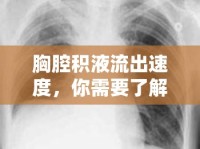 胸腔積液流出速度，你需要了解的真相