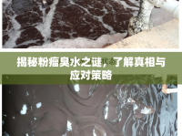 揭秘粉瘤臭水之謎，了解真相與應(yīng)對(duì)策略