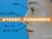 鼻子流出的水，不可忽視的病癥信號