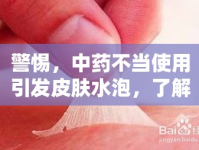 警惕，中藥不當使用引發(fā)皮膚水泡，了解真相與應(yīng)對措施