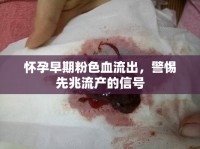 懷孕早期粉色血流出，警惕先兆流產(chǎn)的信號