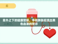 意外之下的健康警報(bào)，手指腫脹后流出黑色血液的警示