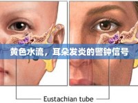 黃色水流，耳朵發(fā)炎的警鐘信號