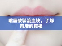 嘴唇破裂流血塊，了解背后的真相