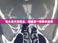 低頭鼻子流黃水，揭秘這一現(xiàn)象的真相