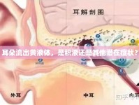 耳朵流出黃液體，是積液還是其他潛在癥狀？