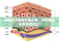 揭秘鼻子里的不速之客，為何表皮會(huì)有東西流出？