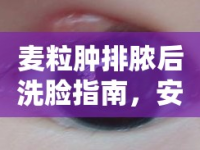 麥粒腫排膿后洗臉指南，安全與舒適的雙重保障